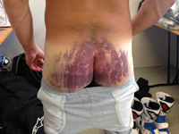 Paul Denning salue le courage de Randy de Puniet