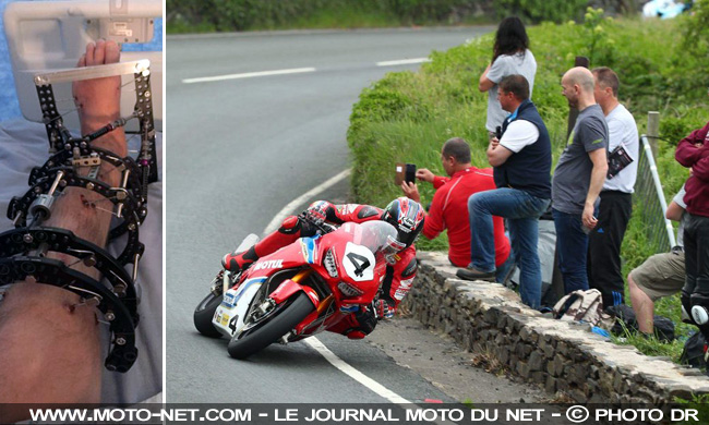 Tourist Trophy 2018 : victoire record(s) pour Hickman à la Senior TT